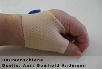 Foto Handtherapie Foto Handtherapie