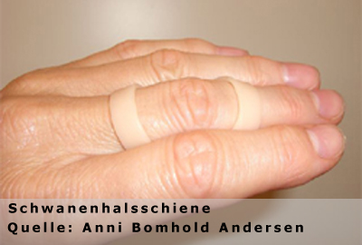 Foto Handtherapie Foto Handtherapie